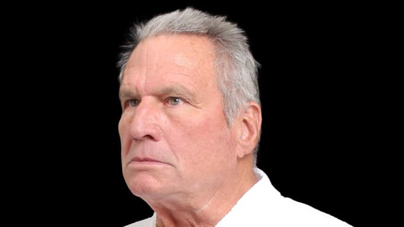 Facelift Before & After Gallery - Patient 392757 - Image 3