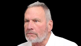 Facelift Before & After Gallery - Patient 392757 - Image 4