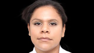 Rhinoplasty Before & After Gallery - Patient 325505 - Image 2