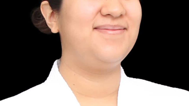 Chin Liposuction Before & After Gallery - Patient 366161 - Image 9