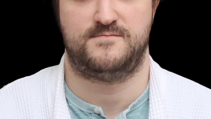 Chin Liposuction Before & After Gallery - Patient 648385 - Image 1