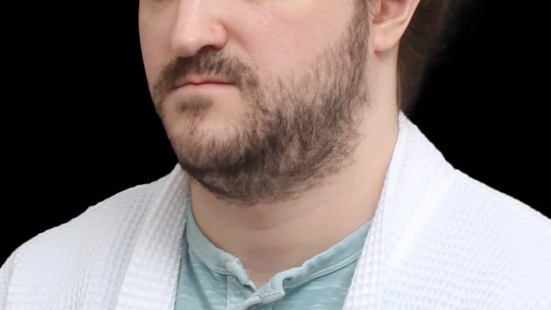 Chin Liposuction Before & After Gallery - Patient 648385 - Image 5