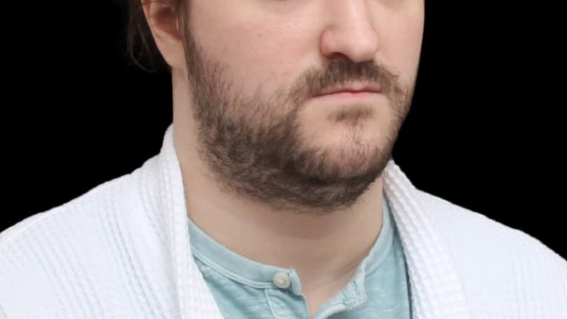 Chin Liposuction Before & After Gallery - Patient 648385 - Image 9