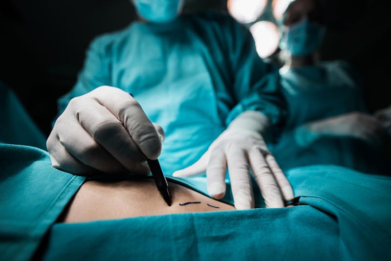 plastic surgeon performing surgery