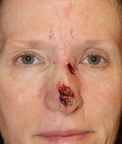 Miscellaneous Before & After Gallery - Patient 263256 - Image 1