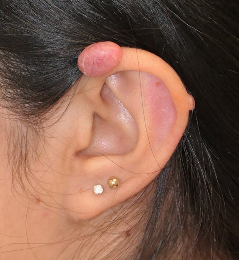 Miscellaneous Before & After Gallery - Patient 566809 - Image 3