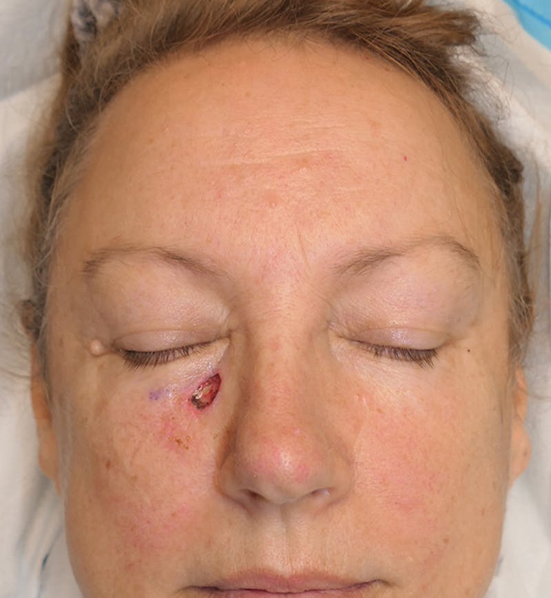 Miscellaneous Before & After Gallery - Patient 724175 - Image 5