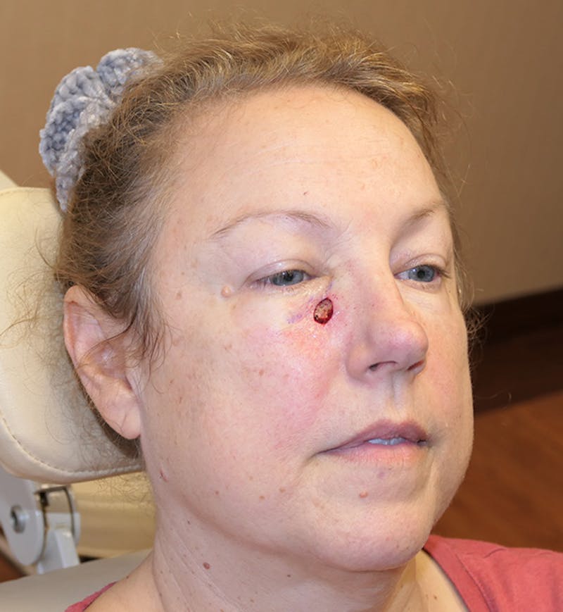 Miscellaneous Before & After Gallery - Patient 724175 - Image 3