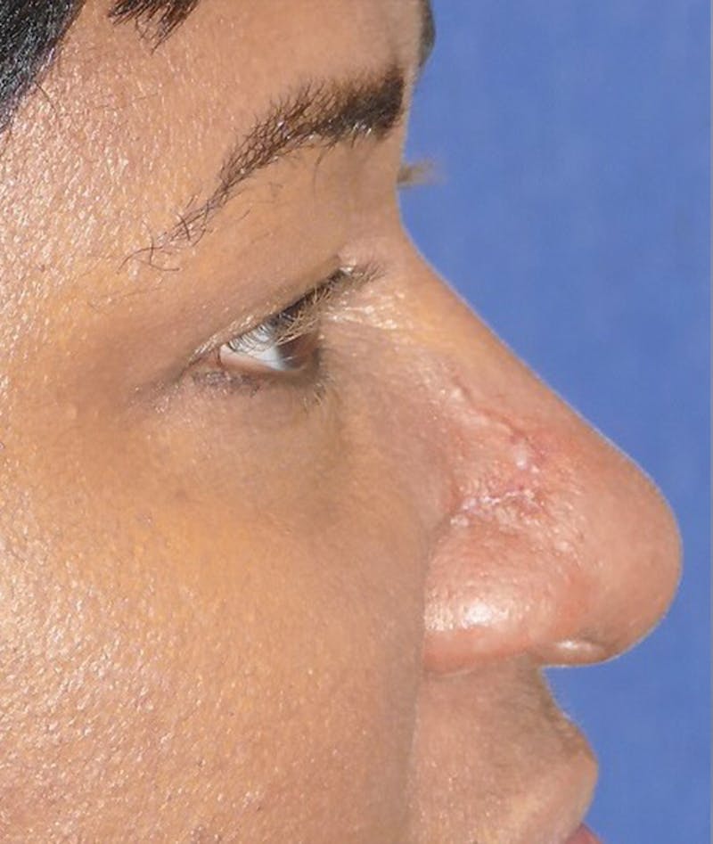 Miscellaneous Before & After Gallery - Patient 239870 - Image 8