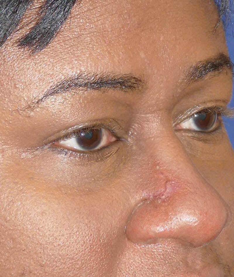 Miscellaneous Before & After Gallery - Patient 239870 - Image 6