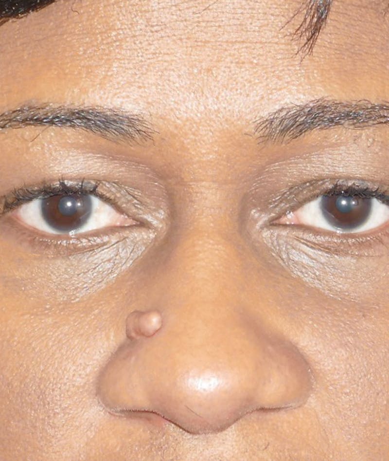 Miscellaneous Before & After Gallery - Patient 239870 - Image 3