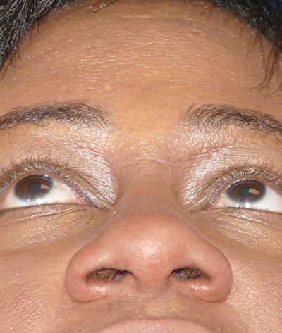Miscellaneous Before & After Gallery - Patient 239870 - Image 2