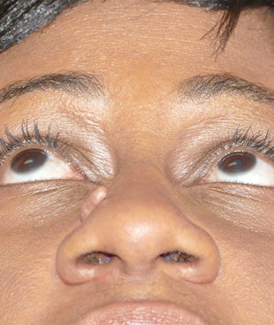 Miscellaneous Before & After Gallery - Patient 239870 - Image 1