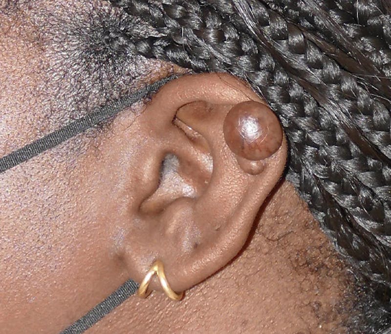 Miscellaneous Before & After Gallery - Patient 320329 - Image 3