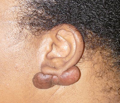 Miscellaneous Before & After Gallery - Patient 379329 - Image 1