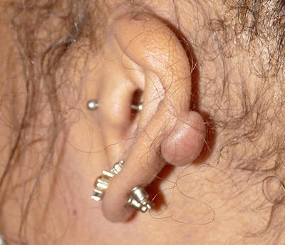 Miscellaneous Before & After Gallery - Patient 373334 - Image 1