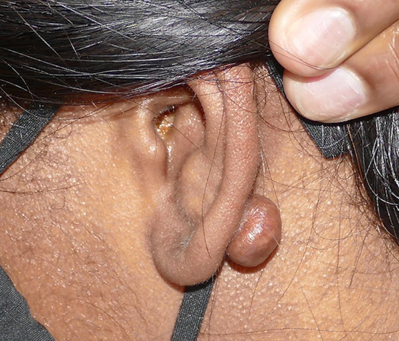 Miscellaneous Before & After Gallery - Patient 338871 - Image 3