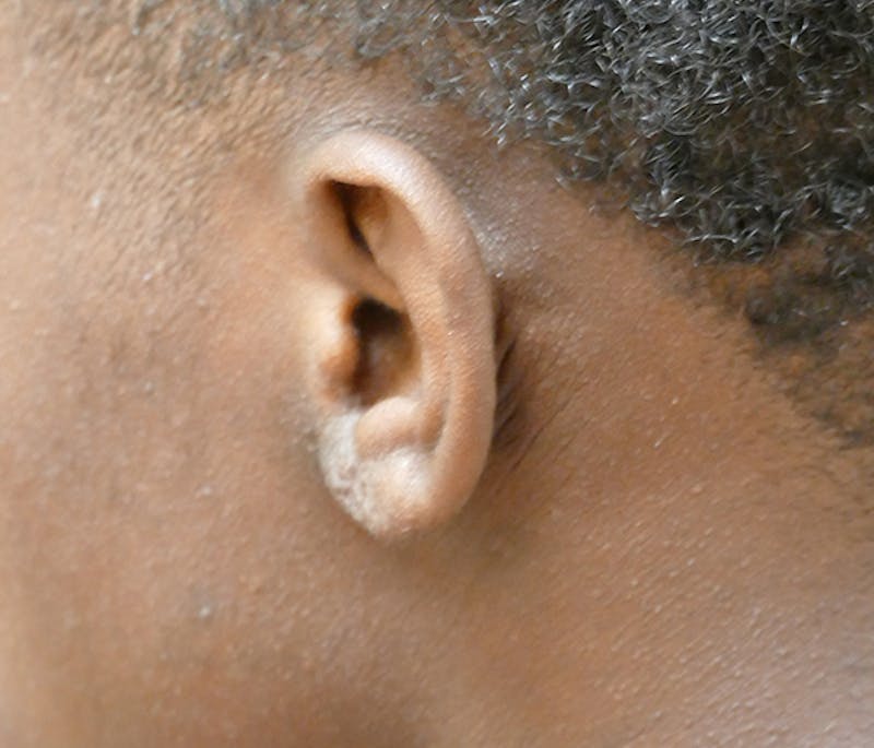 Miscellaneous Before & After Gallery - Patient 195022 - Image 4