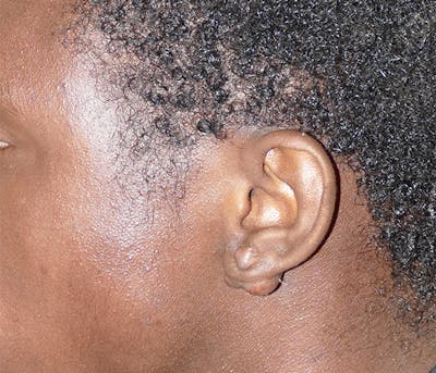 Miscellaneous Before & After Gallery - Patient 195022 - Image 1