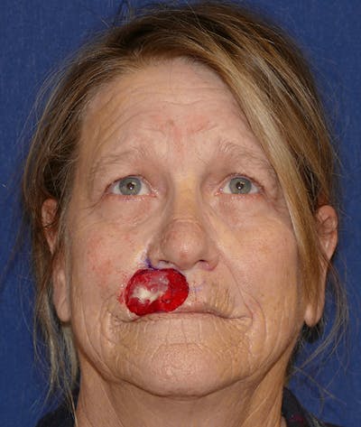 Miscellaneous Before & After Gallery - Patient 190726 - Image 1
