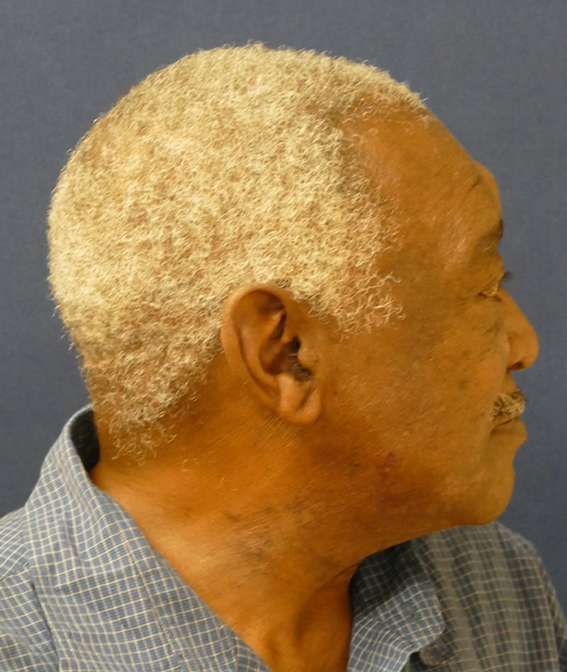 Miscellaneous Before & After Gallery - Patient 855871 - Image 8