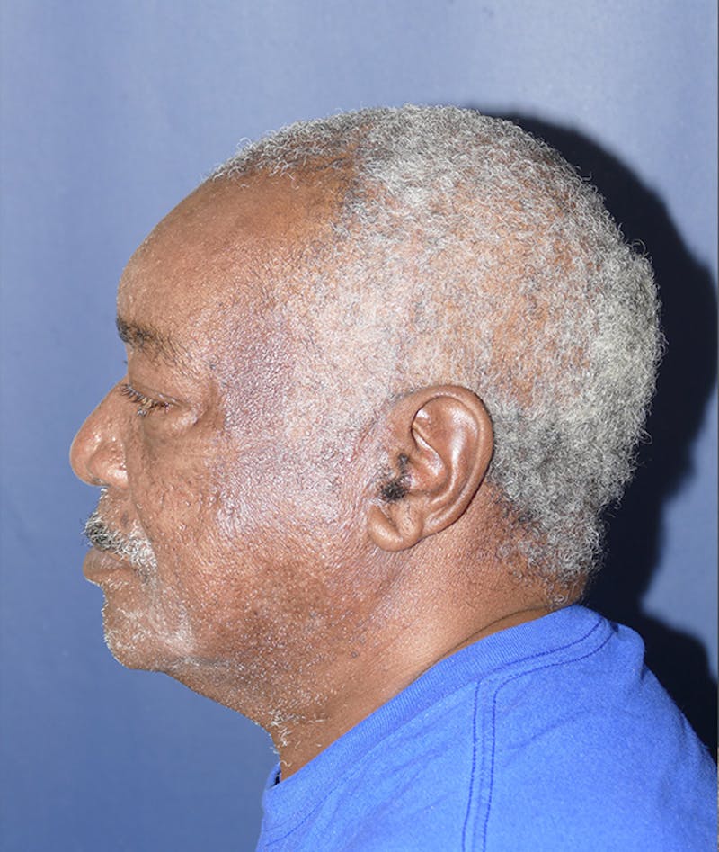 Miscellaneous Before & After Gallery - Patient 855871 - Image 6