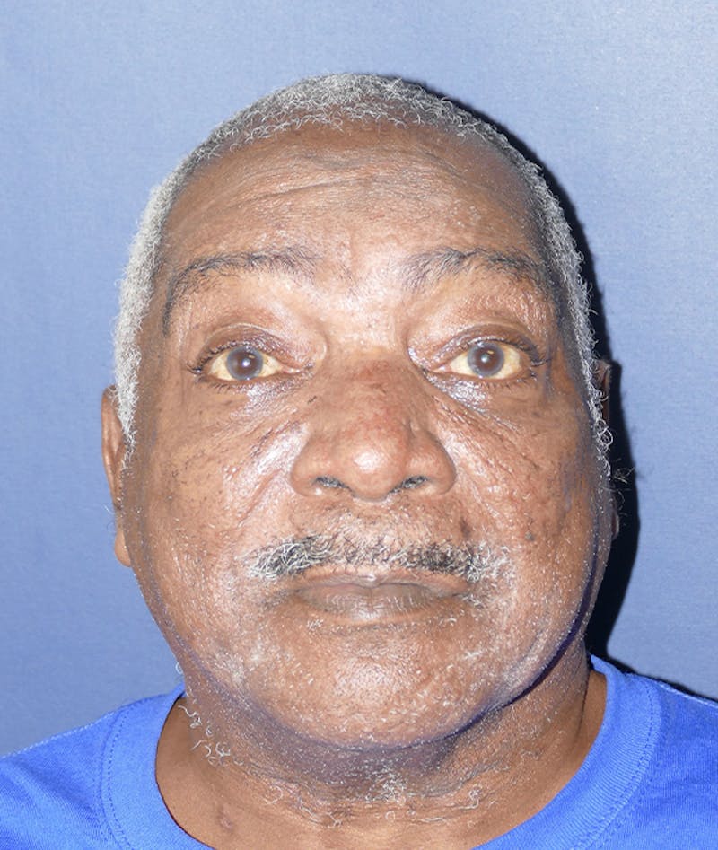 Miscellaneous Before & After Gallery - Patient 855871 - Image 4