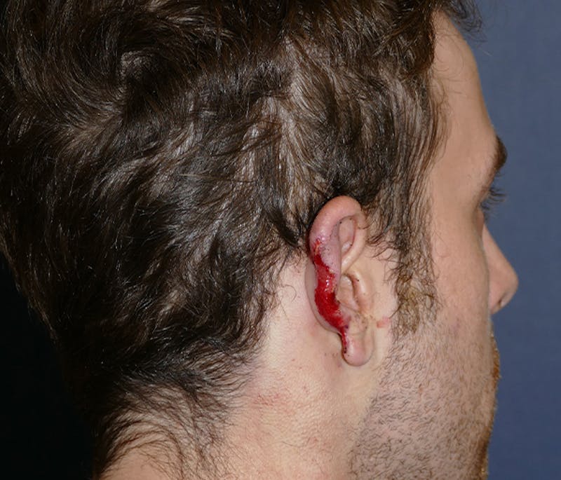 Miscellaneous Before & After Gallery - Patient 239162 - Image 7