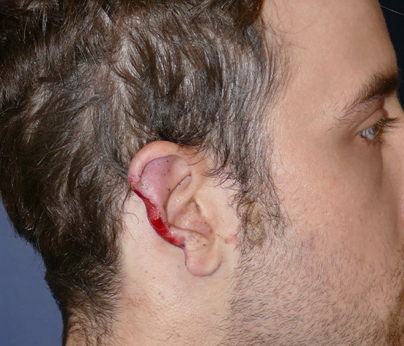Miscellaneous Before & After Gallery - Patient 239162 - Image 6