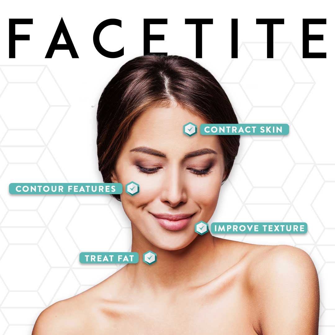  facetite infographic