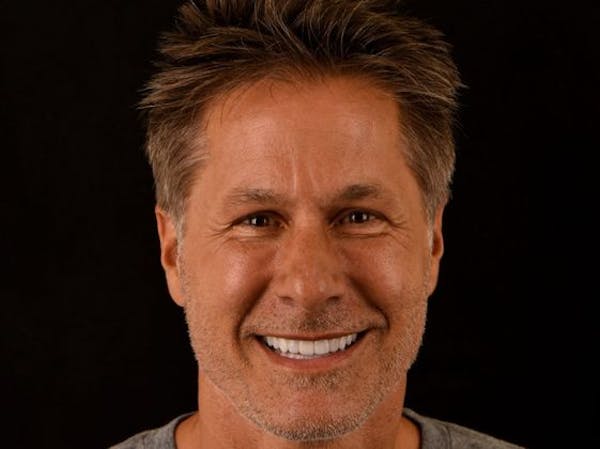 Full Mouth Reconstruction Before & After Gallery - Patient 3013897 - Image 6