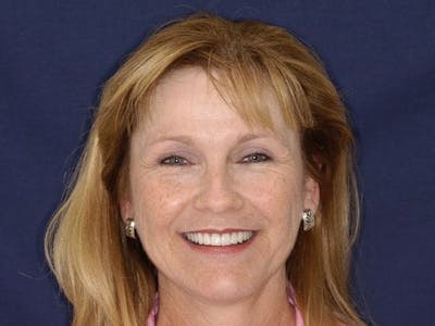 Person smiling