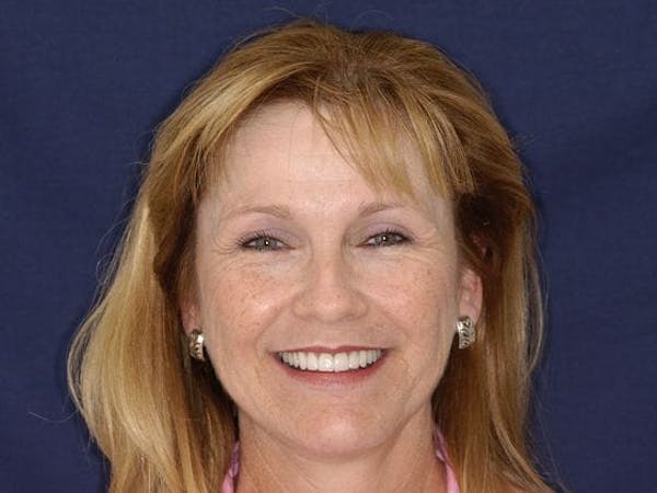 Person smiling