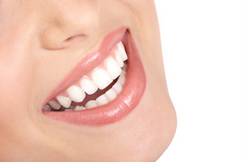 Charleston Dental Bonding vs. Porcelain Veneers