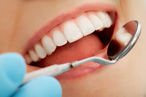 Charleston Tooth Erosion Treatment