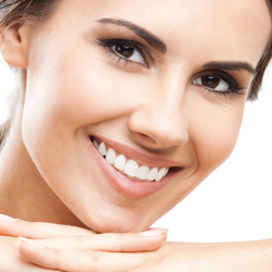 Woman with Porcelain Dental Veneers