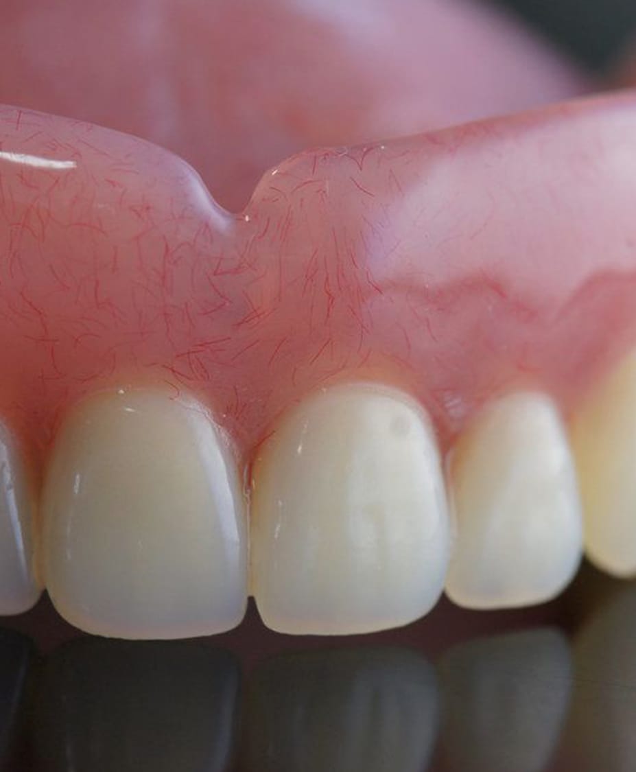 Cost of Dentures Dr. John F. Rink