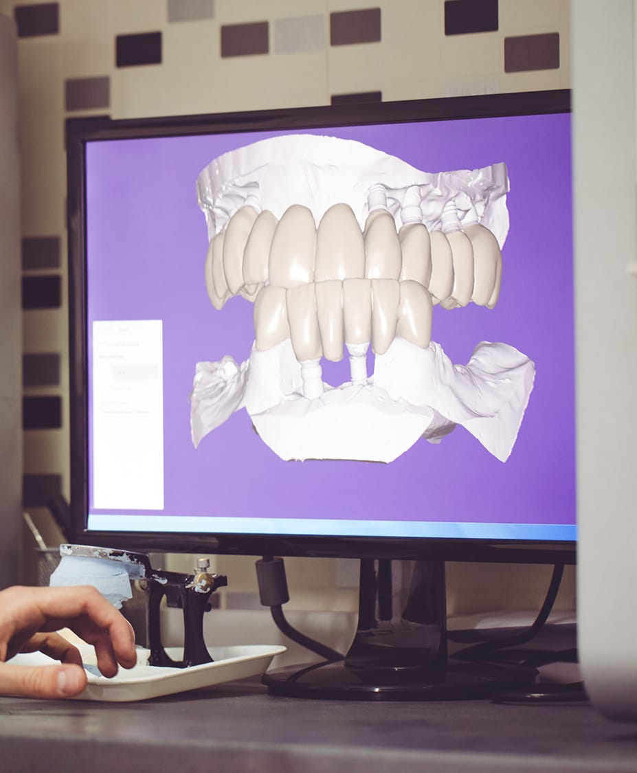Digital Impressions Dr. John F. Rink