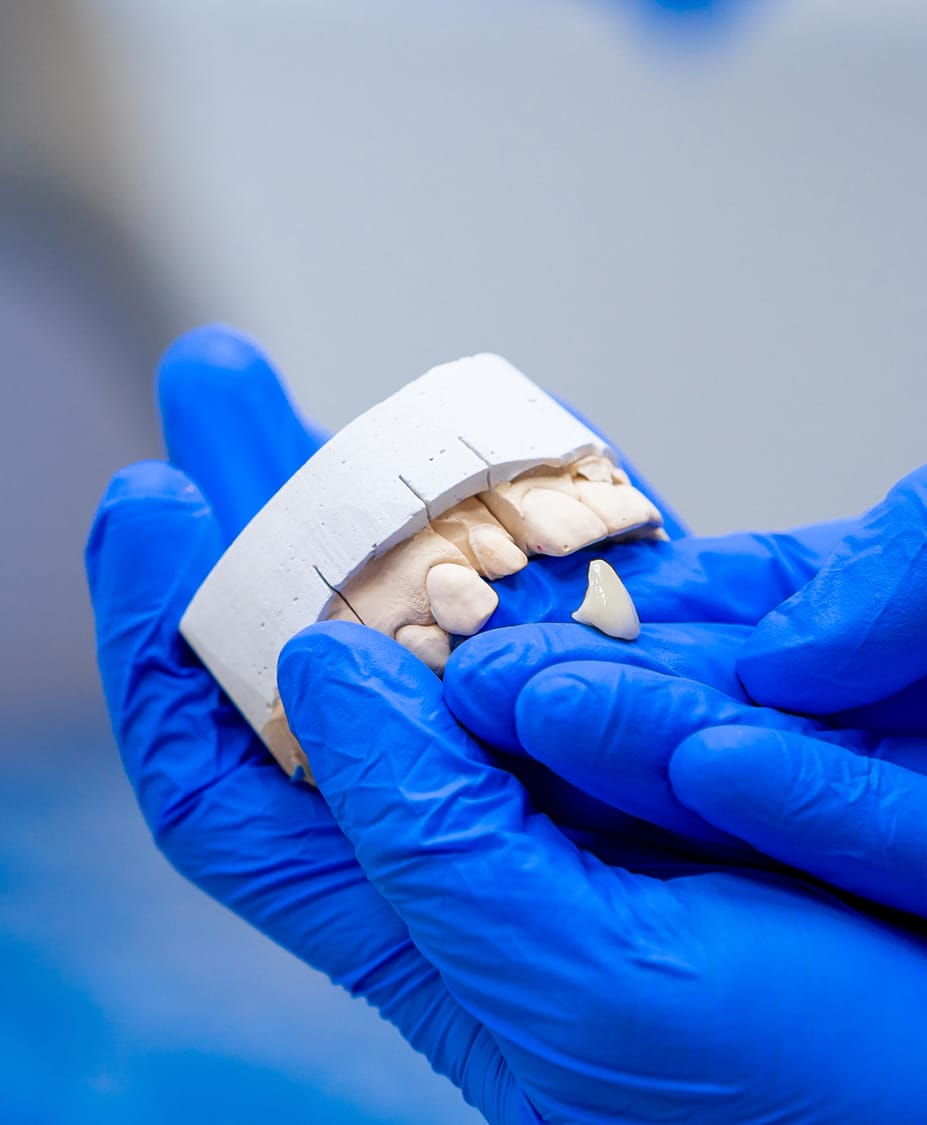 Procedure for ImplantSupported Dentures Dr. John F. Rink