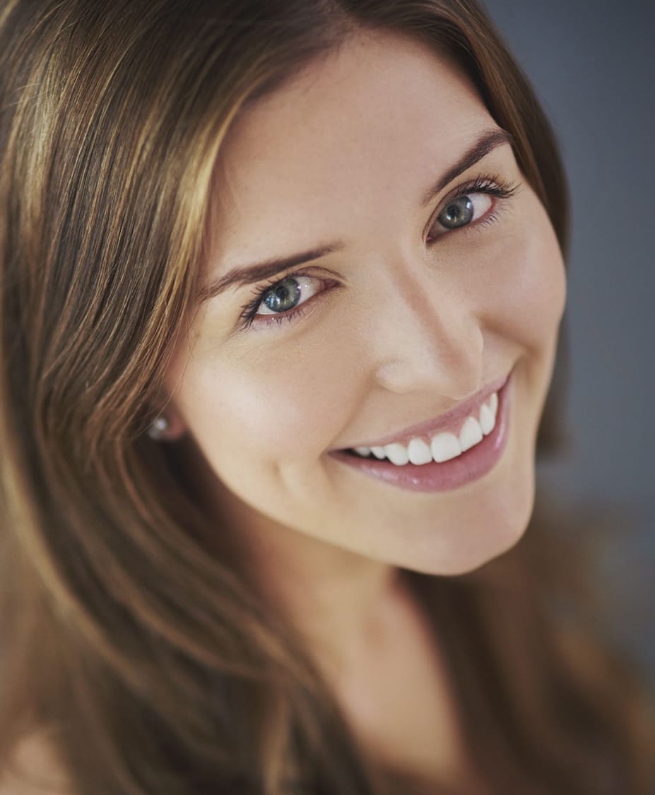 Smile Makeover Charleston Smile Makeover Mt. Pleasant