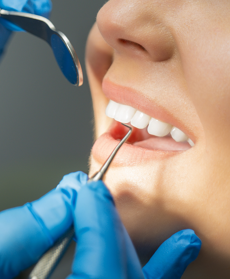 Cost of Veneers Charleston Center For Cosmetic Dentistry