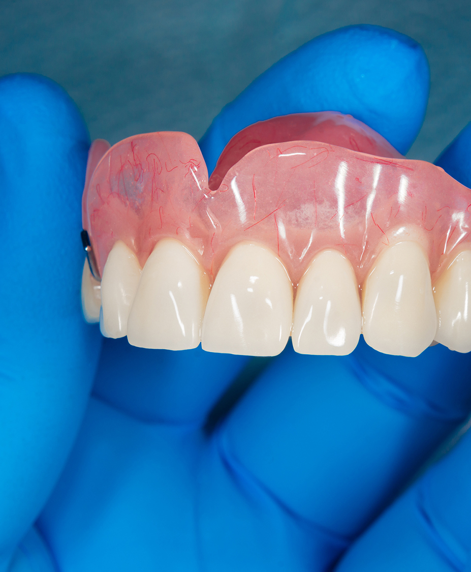 Alternatives to Dentures Dr. John F. Rink