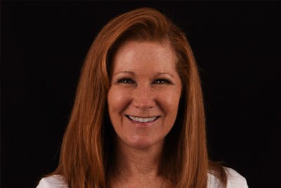 Full Mouth Reconstruction Before & After Gallery - Patient 7316549 - Image 4