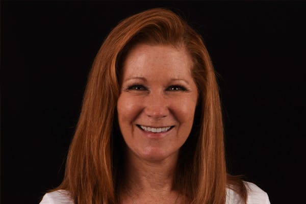 Full Mouth Reconstruction Before & After Gallery - Patient 7316549 - Image 4
