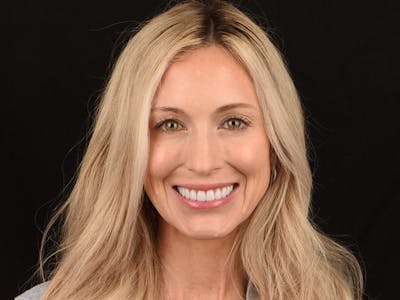 Porcelain Veneers Before & After Gallery - Patient 140400262 - Image 4
