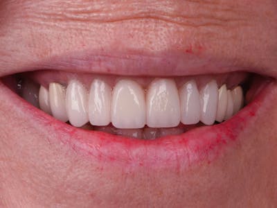 Photo of teeth