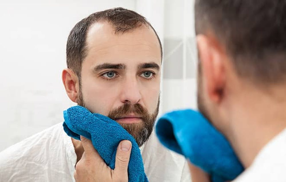 Every surgery has its risks, even beard transplants.