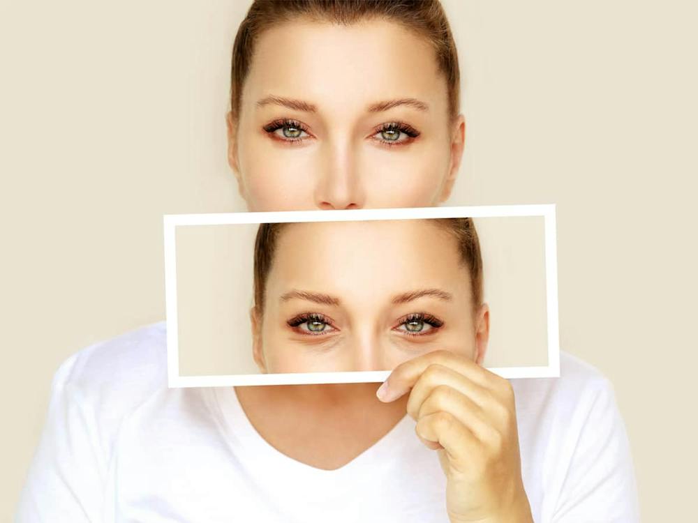 Blepharoplasty can help restore the natural appearance of the eyes by removing excess skin, fat, and muscle.