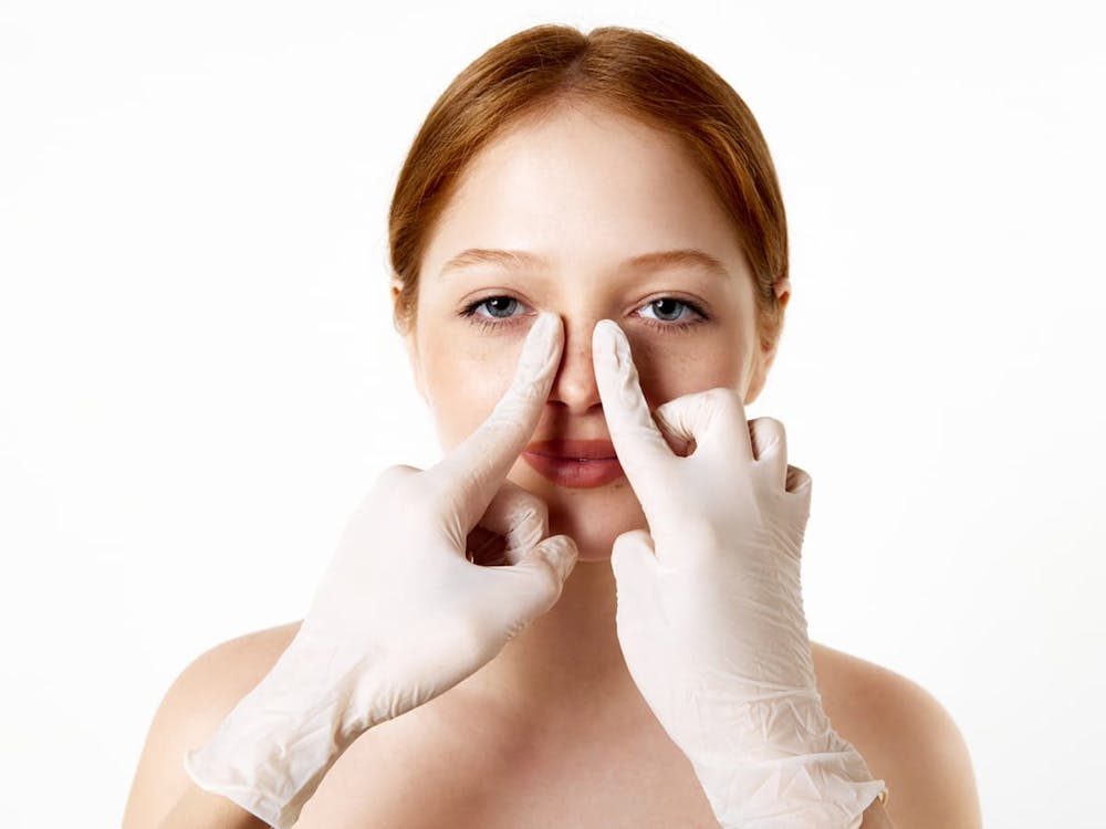 Dr. Anthony Bared is highly experienced in advanced rhinoplasty techniques to provide the best results for his patients.