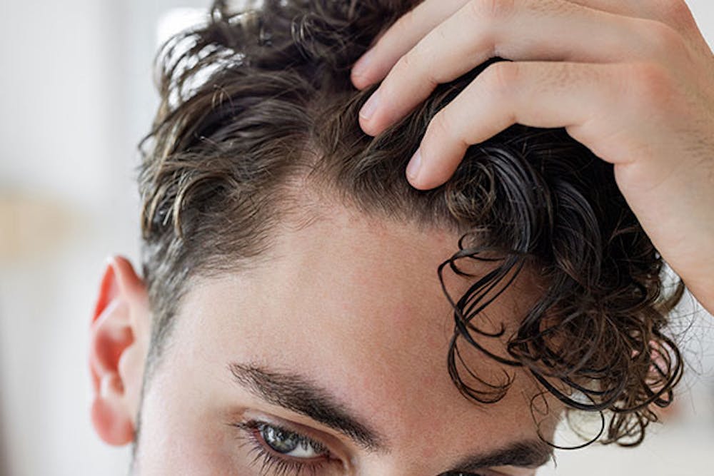 man after a hair transplant in Miami